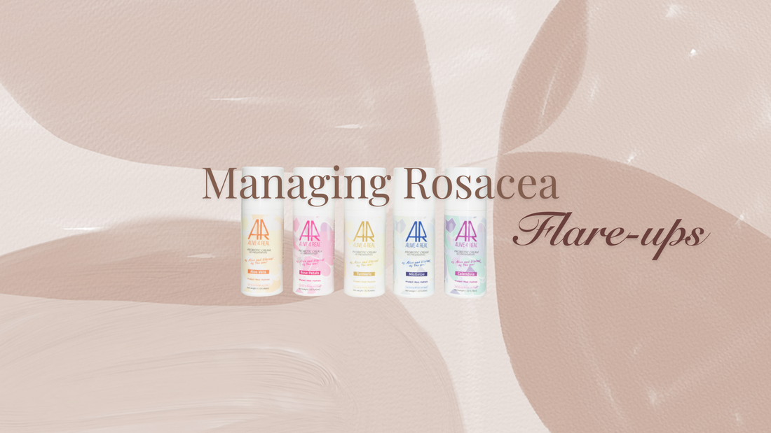 Managing Rosacea Flare-Ups with Live Probiotic Formulas