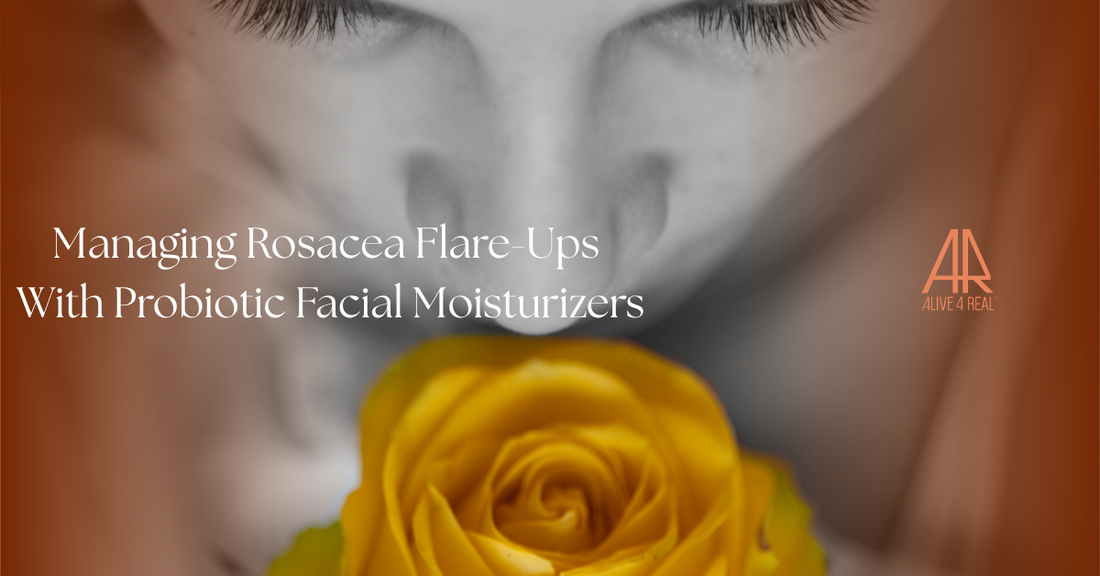 Managing Rosacea Flare-Ups With Probiotic Facial Moisturizers