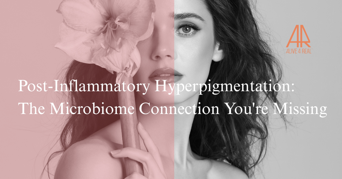 Post-Inflammatory Hyperpigmentation: The Microbiome Connection You're Missing