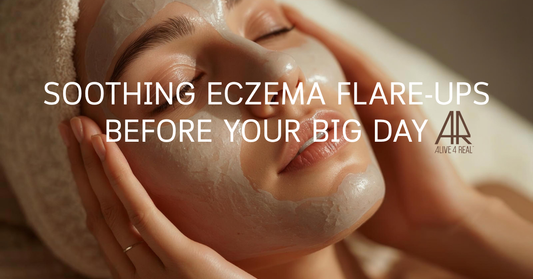 Soothing Eczema Flare-Ups Before Your Big Day