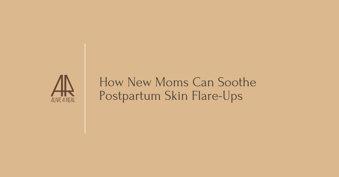 How New Moms Can Soothe Postpartum Skin Flare-Ups