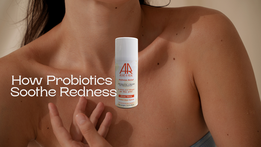 New Moms: Why Probiotics Calm Redness When Creams Fail